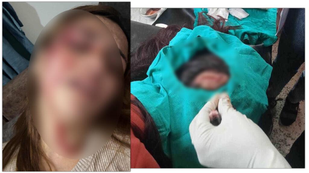 पूर्वपत्नीलाई बलात्कार प्रयासपछि निर्घात कुटपिट गर्ने प्रहरी इन्स्पेक्टर पक्राउ